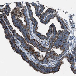 Invitrogen MDH2 Polyclonal Antibody 100 &mu;L | Buy Online | Invitrogen&trade; | Fisher Scientific