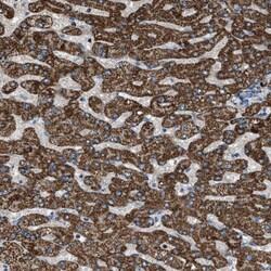 Invitrogen MDH2 Polyclonal Antibody 100 &mu;L | Buy Online | Invitrogen&trade; | Fisher Scientific