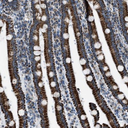 Invitrogen MDH2 Polyclonal Antibody 100 &mu;L; Unconjugated:Antibodies,