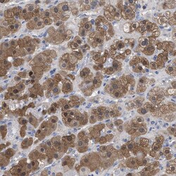 Invitrogen RBKS Polyclonal Antibody 100 &mu;L; Unconjugated:Antibodies,