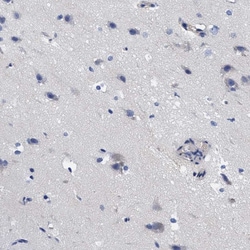 Invitrogen RBKS Polyclonal Antibody 100 &mu;L; Unconjugated:Antibodies,