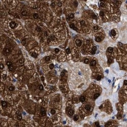 Invitrogen RBKS Polyclonal Antibody 100 &mu;L; Unconjugated:Antibodies,