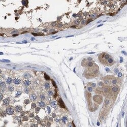Invitrogen RBKS Polyclonal Antibody 100 &mu;L; Unconjugated:Antibodies,