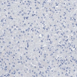 Invitrogen CEA Polyclonal Antibody 100 &mu;L | Buy Online | Invitrogen&trade; | Fisher Scientific