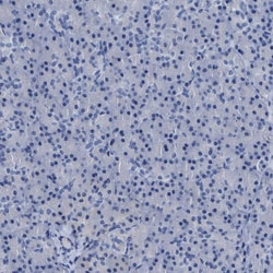 Invitrogen CEA Polyclonal Antibody 100 &mu;L | Buy Online | Invitrogen&trade; | Fisher Scientific