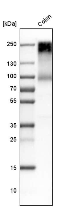 Invitrogen CEA Polyclonal Antibody 100 &mu;L | Buy Online | Invitrogen&trade; | Fisher Scientific