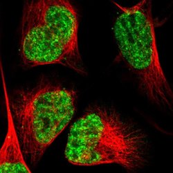ALY Rabbit anti-Human, Polyclonal, Invitrogen 100 &mu;L; Unconjugated:Antibodies,