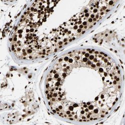 ALY Rabbit anti-Human, Polyclonal, Invitrogen 100 &mu;L; Unconjugated:Antibodies,