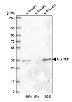 ALY Rabbit anti-Human, Polyclonal, Invitrogen 100 &mu;L; Unconjugated:Antibodies,