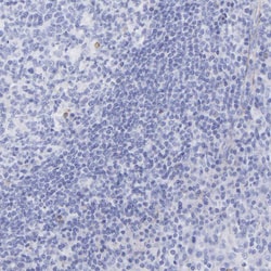 Invitrogen Amphiphysin Polyclonal Antibody 100 &mu;L; Unconjugated:Anticorps,
