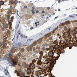 Invitrogen RUVBL1 Polyclonal Antibody 100 &mu;L; Unconjugated:Antibodies,
