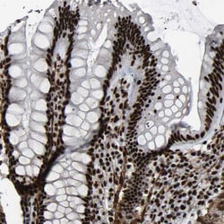 Invitrogen DDX5 Polyclonal Antibody 100 &mu;L; Unconjugated:Antibodies,