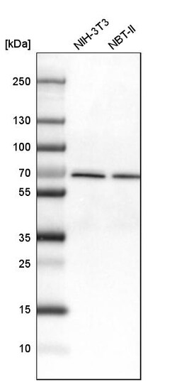 Invitrogen DDX5 Polyclonal Antibody 100 &mu;L; Unconjugated:Antibodies,