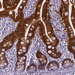 Invitrogen AKR1B10 Polyclonal Antibody 100 &mu;L | Buy Online | Invitrogen&trade; | Fisher Scientific