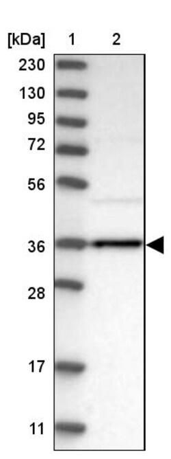 Invitrogen AKR1B10 Polyclonal Antibody 100 &mu;L | Buy Online | Invitrogen&trade; | Fisher Scientific