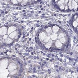 Invitrogen AAK1 Polyclonal Antibody 100 &mu;L; Unconjugated:Antibodies,