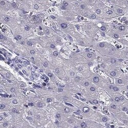 Invitrogen AAK1 Polyclonal Antibody 100 &mu;L; Unconjugated:Antibodies,