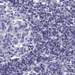 Invitrogen AAK1 Polyclonal Antibody 100 &mu;L; Unconjugated:Antibodies,