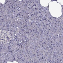 Invitrogen AAK1 Polyclonal Antibody 100 &mu;L; Unconjugated:Antibodies,