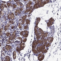 Invitrogen AAK1 Polyclonal Antibody 100 &mu;L; Unconjugated:Antibodies,