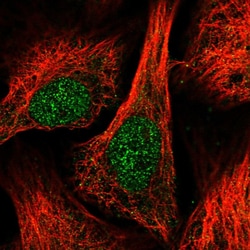 Invitrogen DUSP16 Polyclonal Antibody 100 &mu;L; Unconjugated:Antibodies,