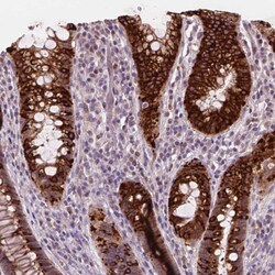 Invitrogen DUSP16 Polyclonal Antibody 100 &mu;L; Unconjugated:Antibodies,