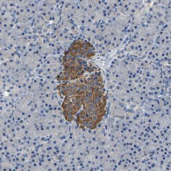 Invitrogen SLC25A25 Polyclonal Antibody 100 &mu;L; Unconjugated:Antibodies,