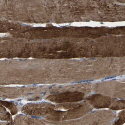 Invitrogen SLC25A25 Polyclonal Antibody 100 &mu;L; Unconjugated:Antibodies,
