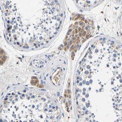 Invitrogen SLC25A25 Polyclonal Antibody 100 &mu;L; Unconjugated:Antibodies,
