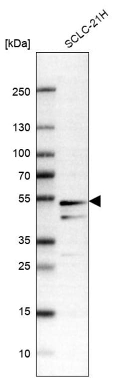 Invitrogen SLC25A25 Polyclonal Antibody 100 &mu;L; Unconjugated:Antibodies,