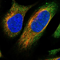 Invitrogen NCKAP1 Polyclonal Antibody 100 &mu;L; Unconjugated:Antibodies,