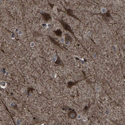 Invitrogen NCKAP1 Polyclonal Antibody 100 &mu;L; Unconjugated:Antibodies,