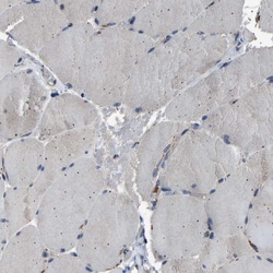 Invitrogen NCKAP1 Polyclonal Antibody 100 &mu;L; Unconjugated:Antibodies,