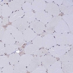 Invitrogen EXOSC3 Polyclonal Antibody 100 &mu;L; Unconjugated:Antibodies
