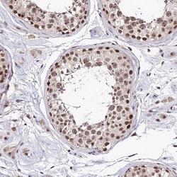 Invitrogen EXOSC3 Polyclonal Antibody 100 &mu;L; Unconjugated:Antibodies