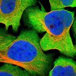 Invitrogen GFR alpha-3 Polyclonal Antibody 100 &mu;L; Unconjugated:Antibodies,