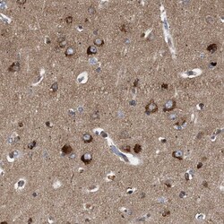 Invitrogen GUCY1B3 Polyclonal Antibody 100 &mu;L; Unconjugated:Antibodies,