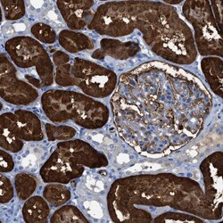 Invitrogen ASS1 Polyclonal Antibody 100 &mu;L; Unconjugated:Antibodies,