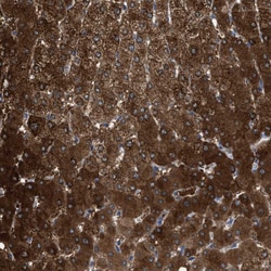 Invitrogen ASS1 Polyclonal Antibody 100 &mu;L; Unconjugated:Antibodies,