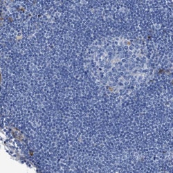 Invitrogen ASS1 Polyclonal Antibody 100 &mu;L; Unconjugated:Antibodies,