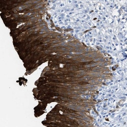 Invitrogen ASS1 Polyclonal Antibody 100 &mu;L; Unconjugated:Antibodies,