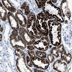 Invitrogen AMACR Polyclonal Antibody 100 &mu;L | Buy Online | Invitrogen&trade; | Fisher Scientific