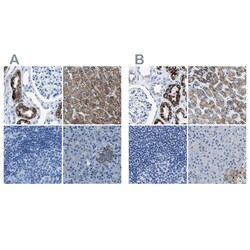 Invitrogen AMACR Polyclonal Antibody 100 &mu;L | Buy Online | Invitrogen&trade; | Fisher Scientific