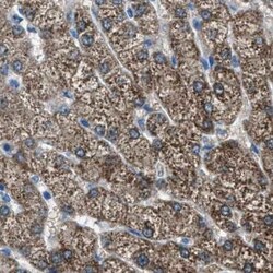 Invitrogen AMACR Polyclonal Antibody 100 &mu;L | Buy Online | Invitrogen&trade; | Fisher Scientific