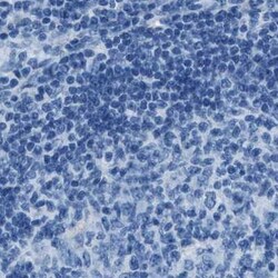 Invitrogen AMACR Polyclonal Antibody 100 &mu;L | Buy Online | Invitrogen&trade; | Fisher Scientific