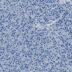Invitrogen AMACR Polyclonal Antibody 100 &mu;L | Buy Online | Invitrogen&trade; | Fisher Scientific