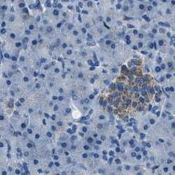 Invitrogen AMACR Polyclonal Antibody 100 &mu;L | Buy Online | Invitrogen&trade; | Fisher Scientific