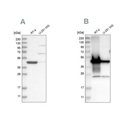 Invitrogen AMACR Polyclonal Antibody 100 &mu;L | Buy Online | Invitrogen&trade; | Fisher Scientific