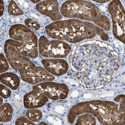 Invitrogen ASS1 Polyclonal Antibody 100 &mu;L; Unconjugated:Antibodies,