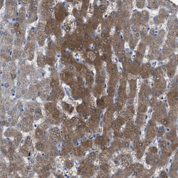 Invitrogen ASS1 Polyclonal Antibody 100 &mu;L; Unconjugated:Antibodies,
